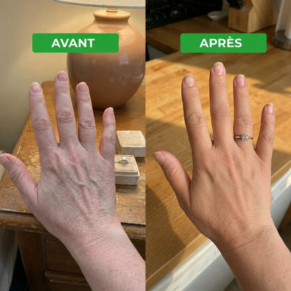 Venera - Drainage lymphatique