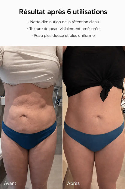 Venera - Une peau visiblement plus lisse en 14 jours