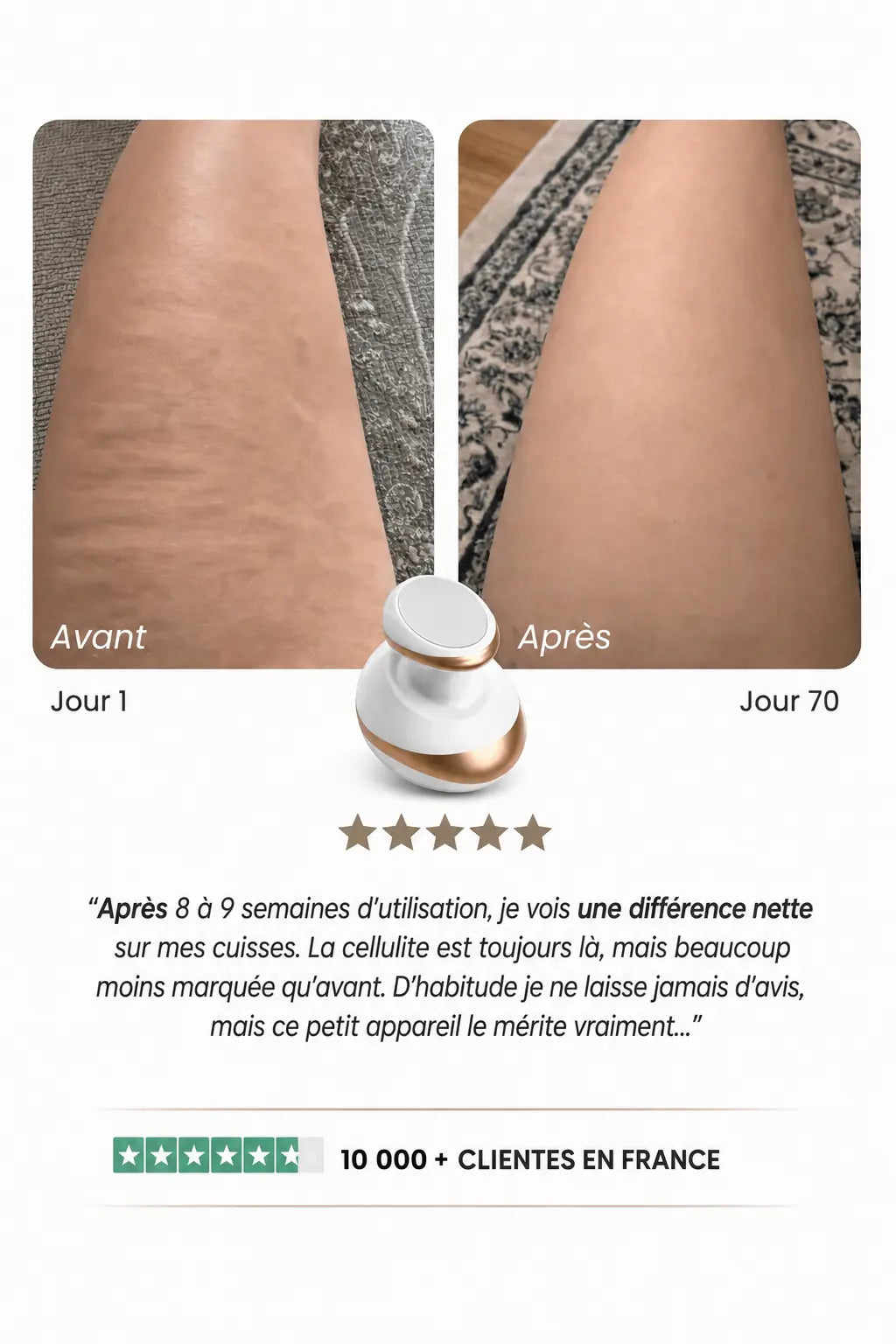 Venera - Une peau visiblement plus lisse en 14 jours