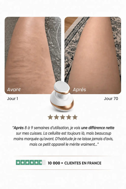 Venera - Une peau visiblement plus lisse en 14 jours